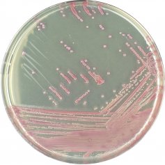 CHROMagar MRSA