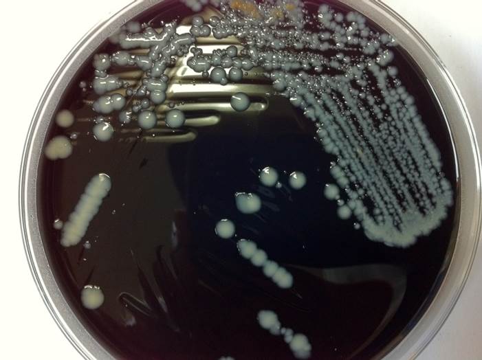 Microaerophilic /Anaerobic agar line