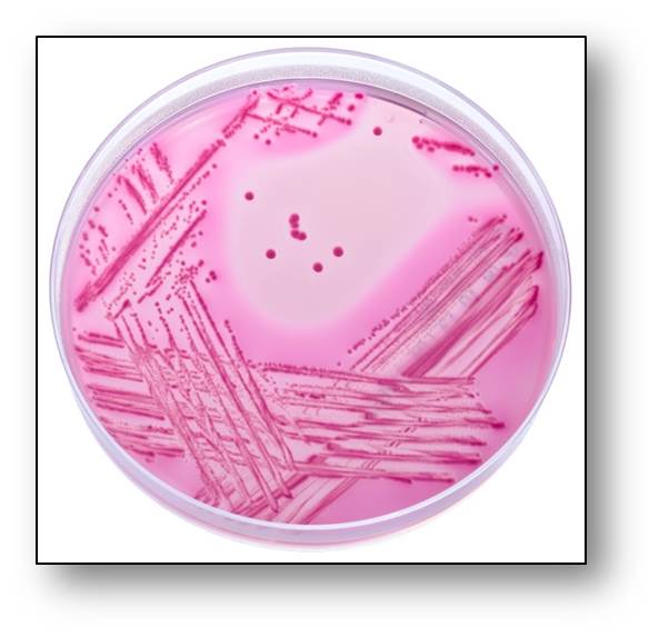 Differentiation agar line